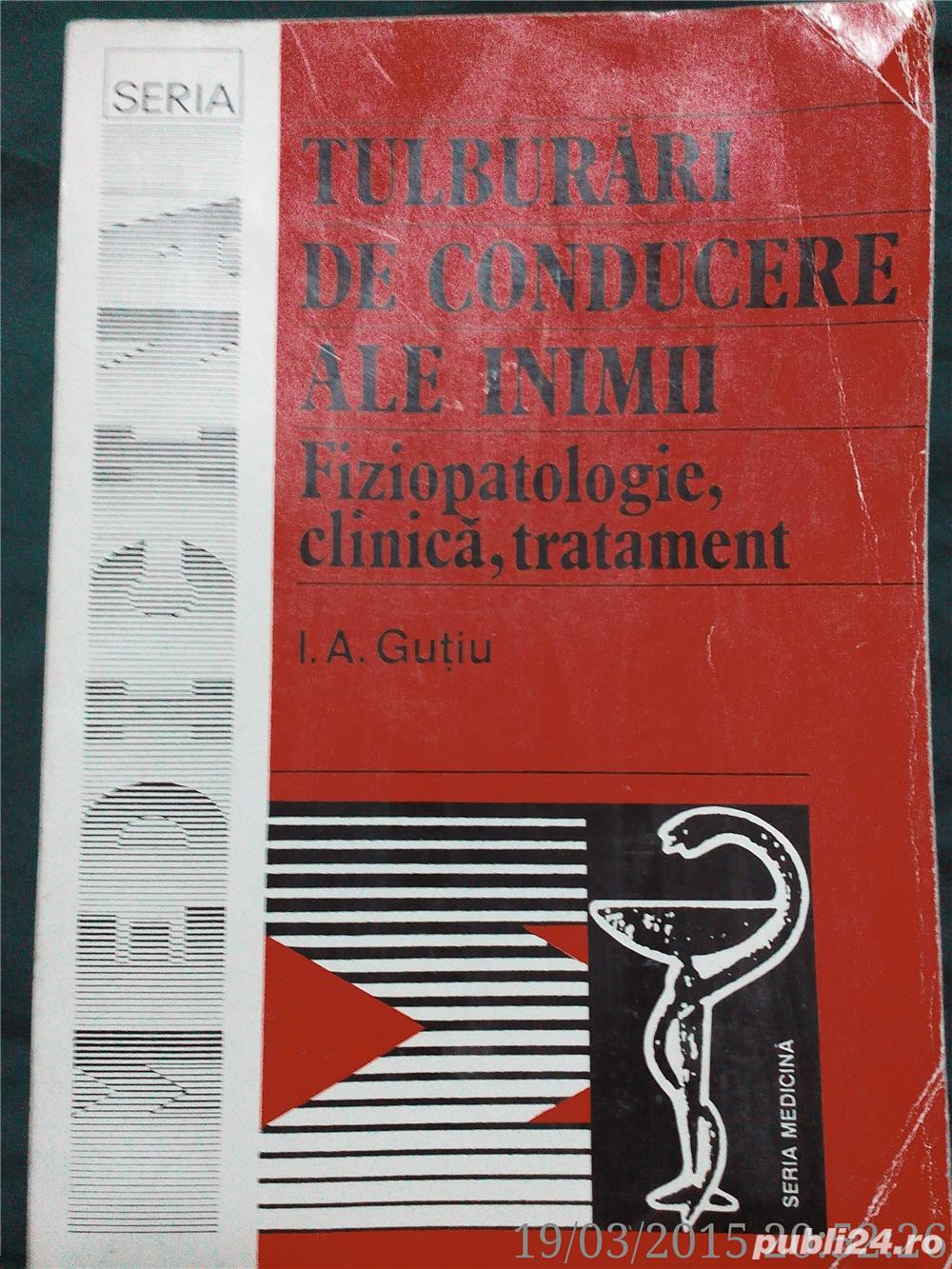 Tulburari de conducere ale inimii-fiziopatologie,clinica,tratament Tulburari de conducere ale inimii-fiziopatologie,clinica,tratament