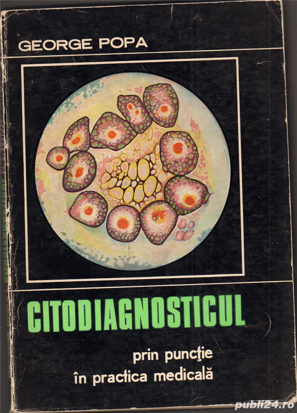 Citodiagnosticul prin punctie in practica medicala , George Popa ,Editura Medicala , Bucuresti 1971