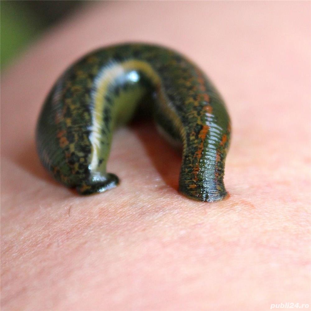 Lipitori Medicinale in Romania