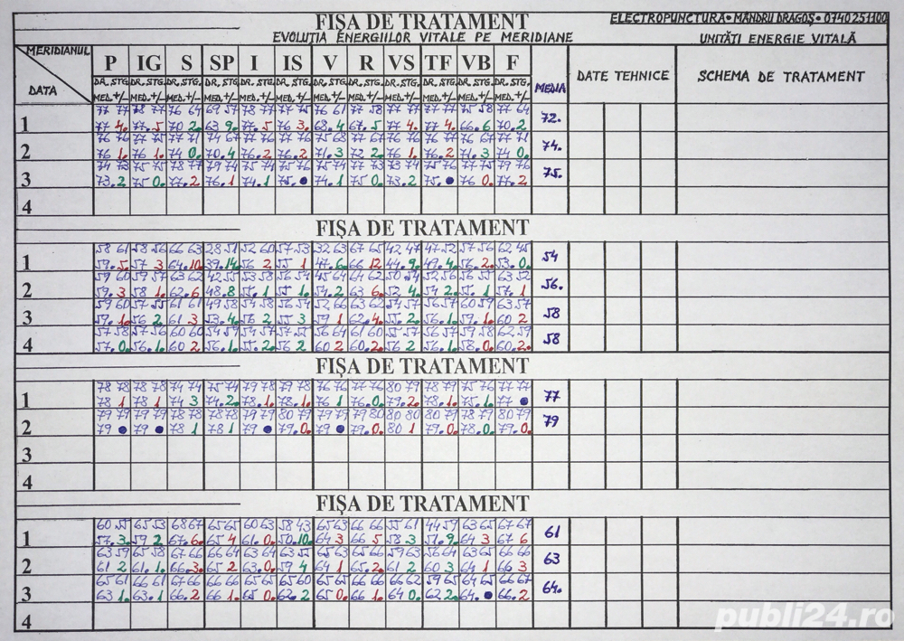 Diagnoză și tratament fără dureri care ameliorează starea generală de sănătate, prin Electropunctură