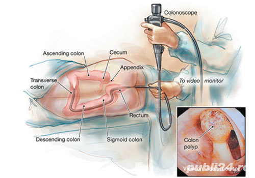 Servicii medicale domiciliu-jud Neamt