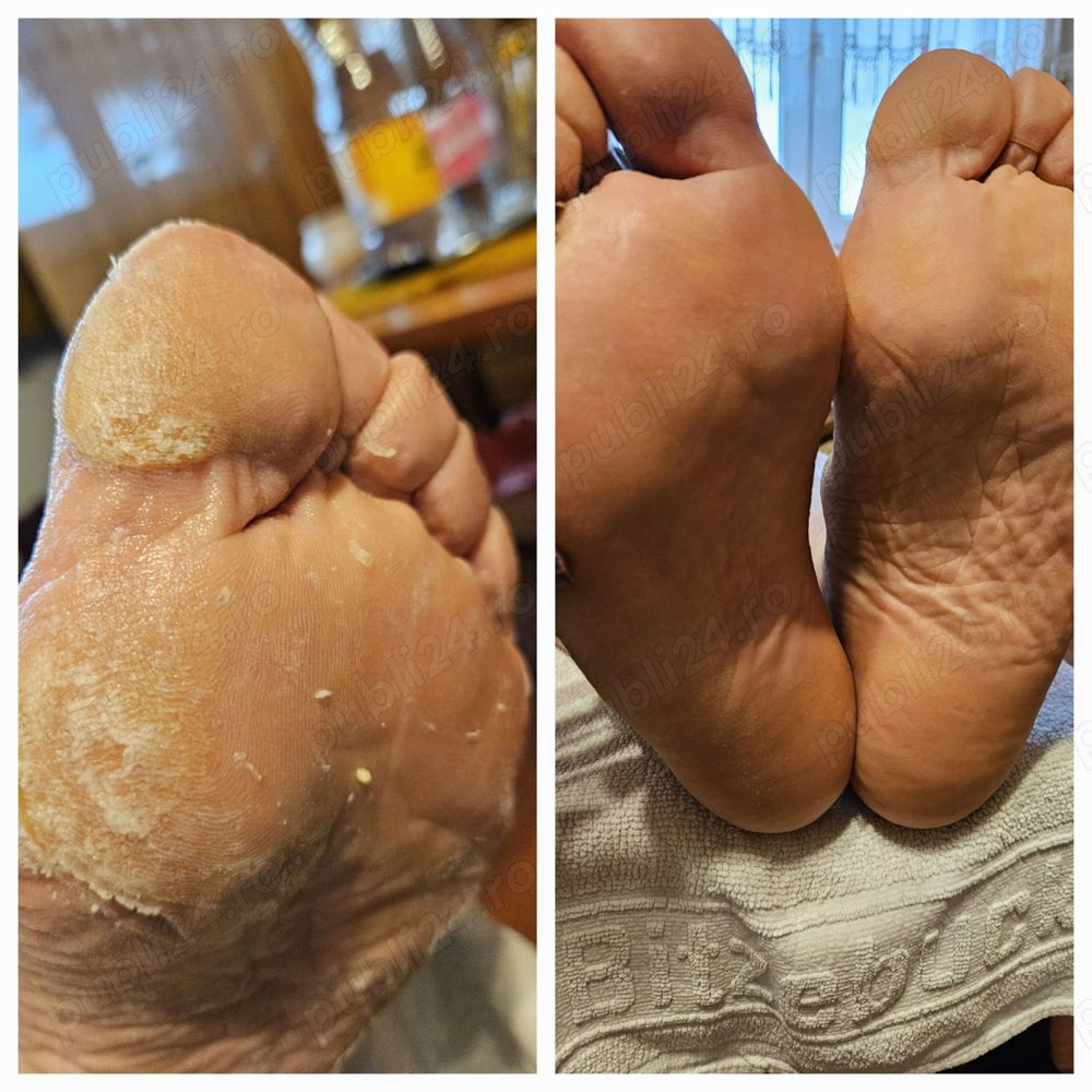 Pedichiura clasică si tratament cu parafină oradea