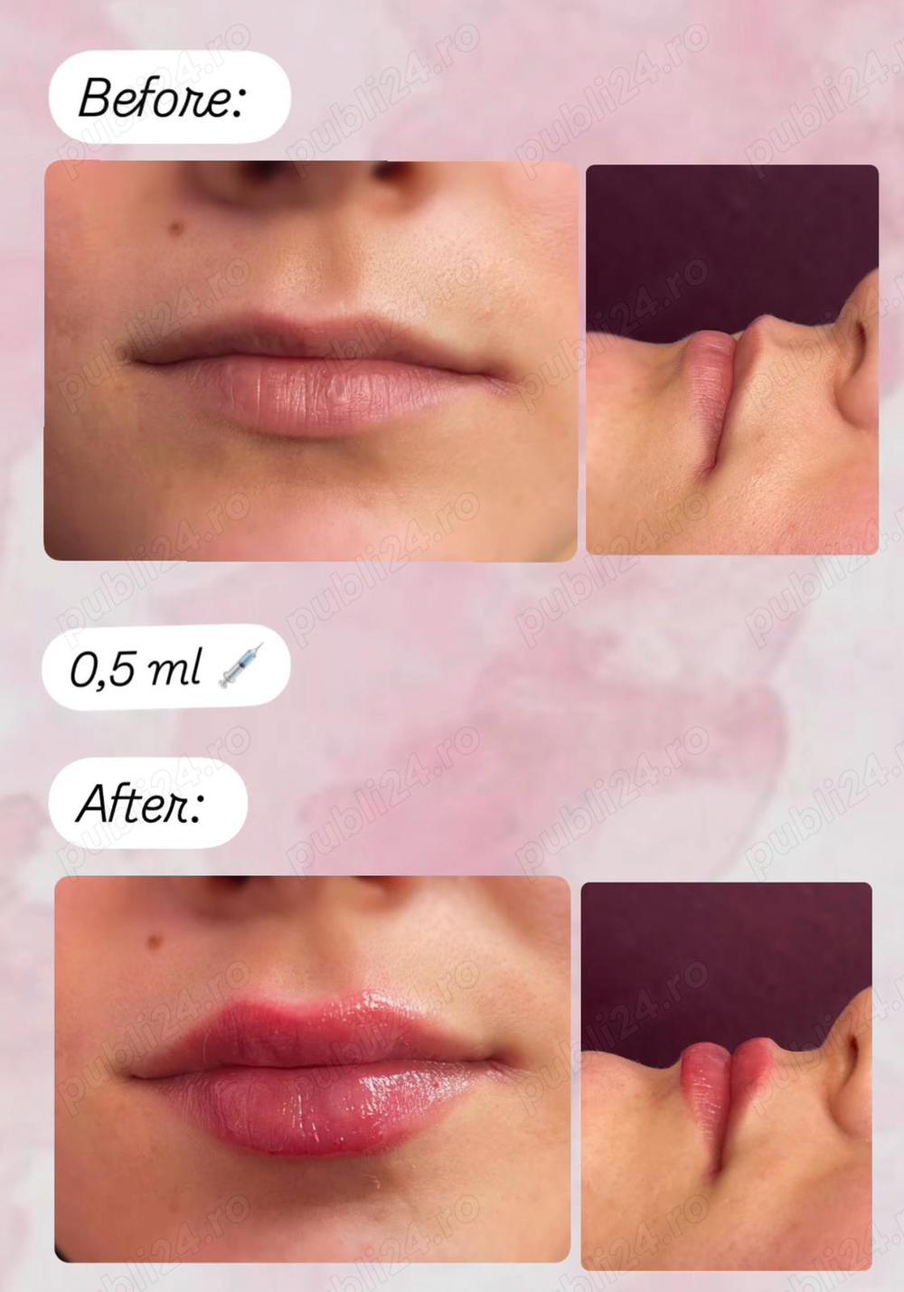 Servicii înfrumusețare 