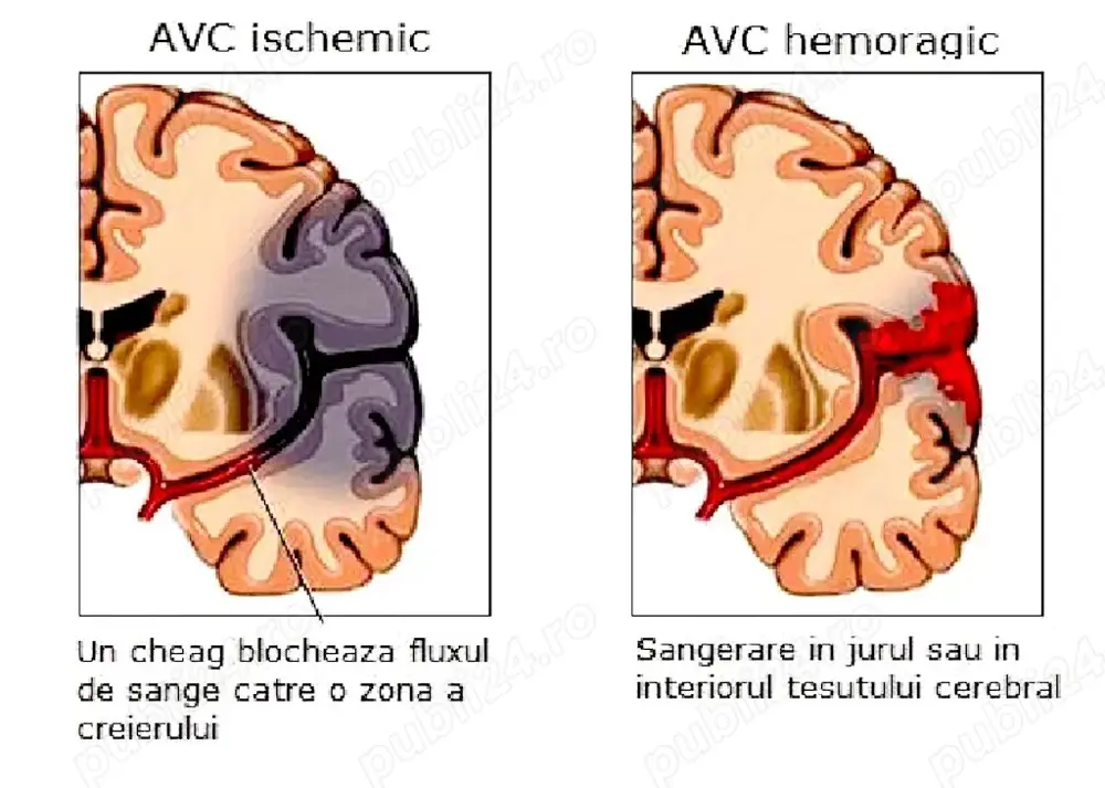 Kinetoterapie si Recuperare Medicala la domiciliul pacientilor in diverse afectiuni