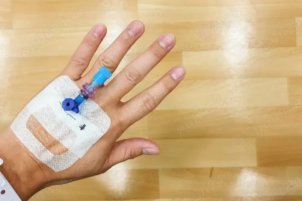 Asistent medical   Montare branule la domiciliu - Brăila 