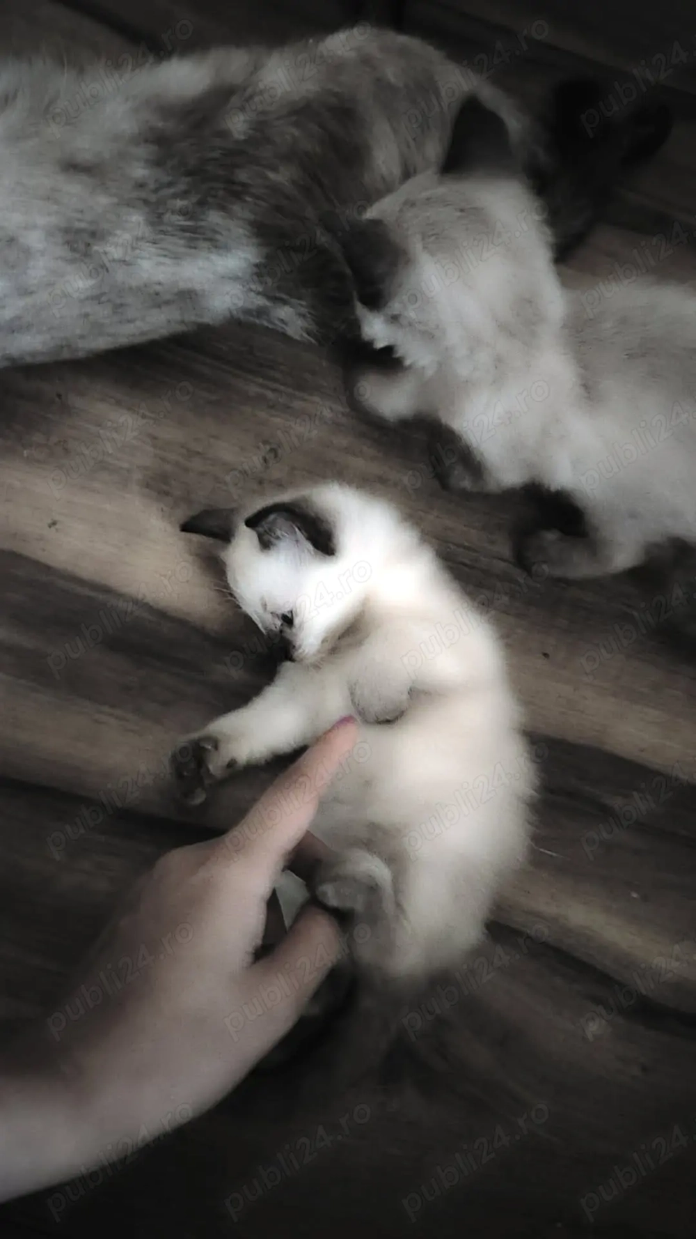 Fetita siamezi patru uni Fetita siamezi patru uni