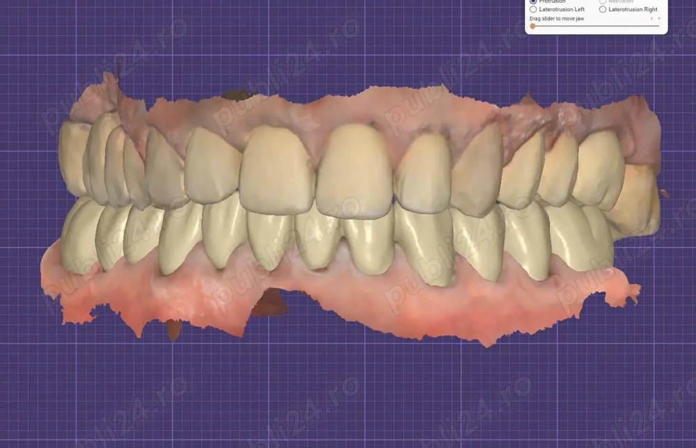 Colaborare pentru design exocad