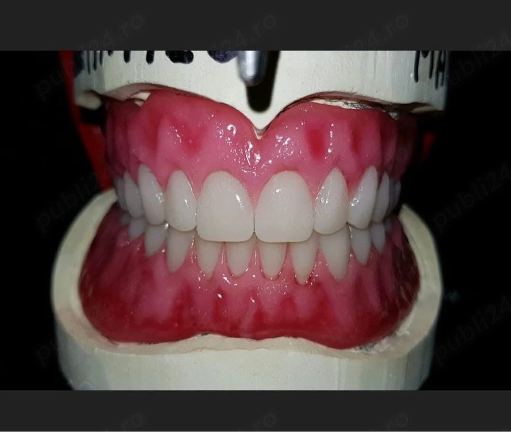tehnician dentar caut joob , doresc seriozitate