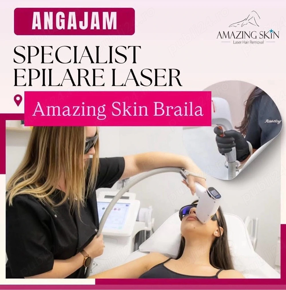 Angajam Specialist Epilare Definitiva