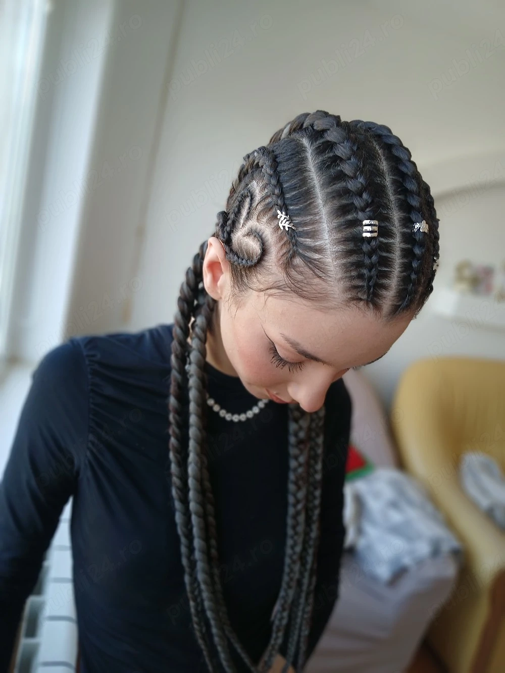 codite impletite pe scalp