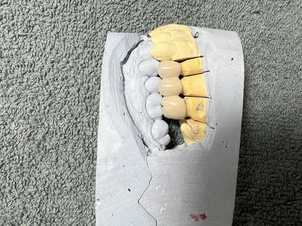 Caut loc de muncă tehnician dentar- Craiova