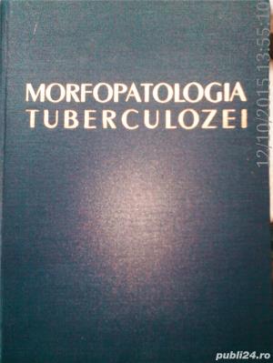 Morfopatologia Tuberculozei Marius Nasta, l.Eskenasy P. Nicolescu 1957