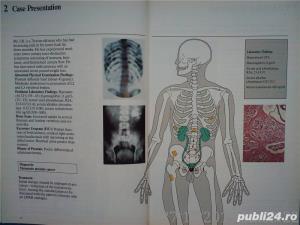 Prostate cancer emphasis and new treatment modalities Voogt , Soloway 1985 - imagine 5