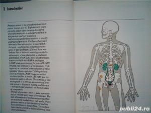 Prostate cancer emphasis and new treatment modalities Voogt , Soloway 1985 - imagine 4