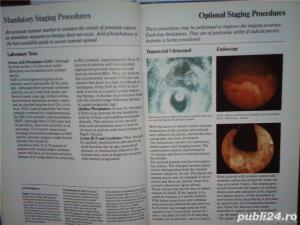 Prostate cancer emphasis and new treatment modalities Voogt , Soloway 1985 - imagine 9