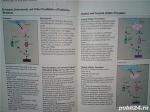 Prostate cancer emphasis and new treatment modalities Voogt , Soloway 1985 - imagine 12