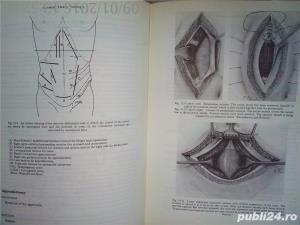 Operating theatre technique R.J. Brigden , SRN , 1980 - imagine 12