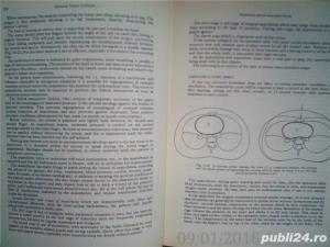 Operating theatre technique R.J. Brigden , SRN , 1980 - imagine 11