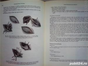 Operating theatre technique R.J. Brigden , SRN , 1980 - imagine 14