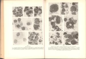 Citodiagnosticul prin punctie in practica medicala , George Popa ,Editura Medicala , Bucuresti 1971 - imagine 17
