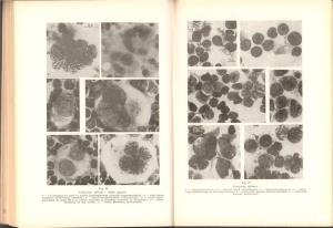 Citodiagnosticul prin punctie in practica medicala , George Popa ,Editura Medicala , Bucuresti 1971 - imagine 18