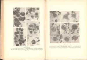 Citodiagnosticul prin punctie in practica medicala , George Popa ,Editura Medicala , Bucuresti 1971 - imagine 19