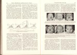 Babcock's Principles and practice of Surgery, Jonas , 1955 - imagine 5
