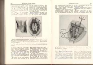 Babcock's Principles and practice of Surgery, Jonas , 1955 - imagine 9