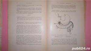 Les pancreatites aigues chirurgicales , Brock, Paris ,1926 - imagine 6