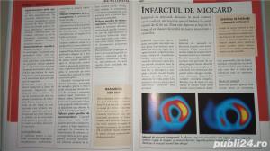 Enciclopedia medicala a familiei, vol.V -Sanatatea inimii, sangelui - imagine 8