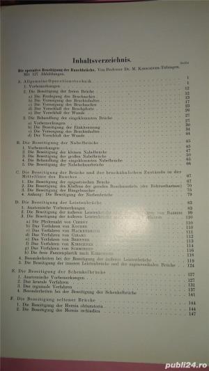 Die Operative Beseitigung der Bauchbruche. Die Eingriffe an den Weiblichen Geschlechtsorganen, - imagine 3