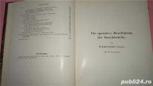 Die Operative Beseitigung der Bauchbruche. Die Eingriffe an den Weiblichen Geschlechtsorganen, - imagine 5