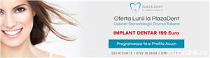 Implant dentar Sector 6 la Clinica Plaza Dent