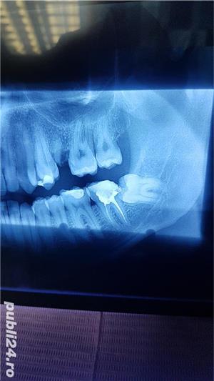 Urgente Pitesti Stomatologie NON-STOP - imagine 3