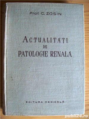 actualitati de patologie renala de  prof c zosin cartonata editura medicala 1958 366 de pagini