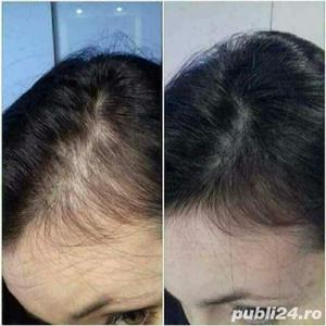 L-RECAPIN-49%REDUCERE-Opreste caderea parului si il regenereaza! - imagine 2