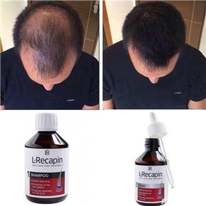 L-RECAPIN-49%REDUCERE-Opreste caderea parului si il regenereaza! - imagine 4