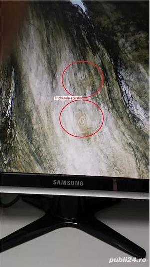 Trichineloscop digital - imagine 8