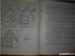 Nouveau traite technique chirurgicale , tome XV , urologie,R. Couvelaire  Patel , xerox legat , 1974 - imagine 3