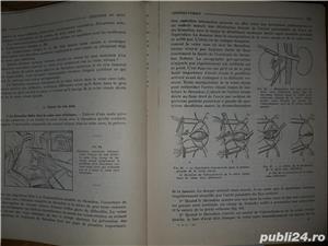 Nouveau traite technique chirurgicale , tome XV , urologie,R. Couvelaire  Patel , xerox legat , 1974 - imagine 2