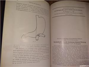 Lucrari chirurgie . Prof.Dr. Hortolomei , 1913-1942 - imagine 2
