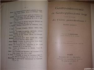 Lucrari chirurgie . Prof.Dr. Hortolomei , 1913-1942 - imagine 5