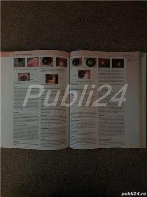 Medicina clinica Kumar si Clark, UK, carte medicina ed. a VII-a 2009 / ed. de buzunar ed. a V-a 2012 - imagine 4