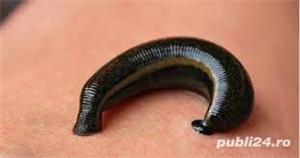 Lipitori Medicinale in Romania - imagine 2