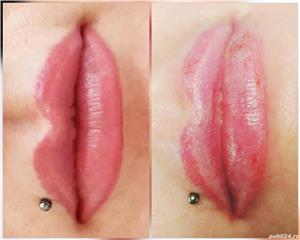 Indepartare tatuaje - imagine 7