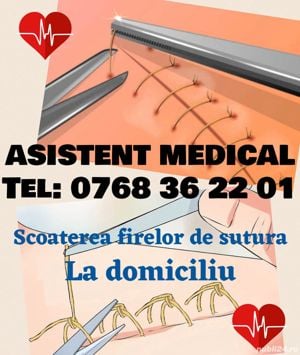 Scoaterea firelor la domiciliu după operatie în București și Ilfov 