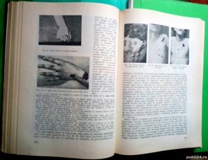 Patologie medico-legala, Gh. Scripcaru - imagine 8