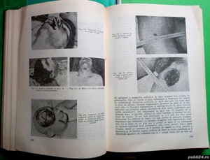 Patologie medico-legala, Gh. Scripcaru - imagine 5