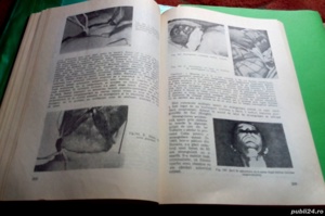 Patologie medico-legala, Gh. Scripcaru - imagine 9