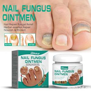 South Moon* 2 buc.-Crema pentru ciuperca unghiilor, elimina ciuperca, regenereaza unghiile - imagine 2